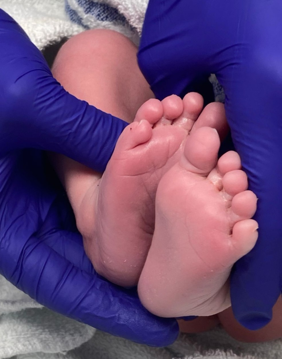 Bebê nasce após transplante de útero em mãe — Foto: Hospital Queen Charlotte's and Chelsea