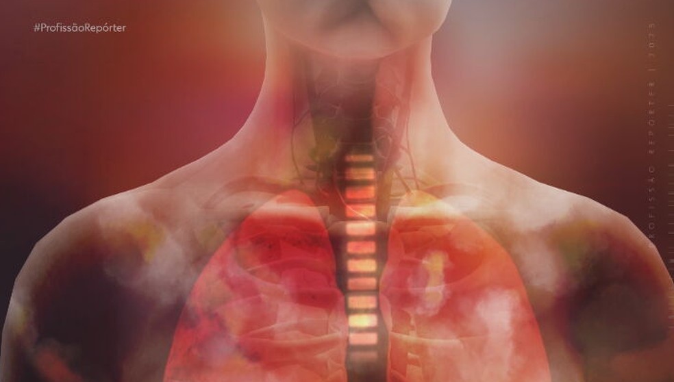 Esclerodermia sistêmica impacta a respiração — Foto: Profissão Repórter