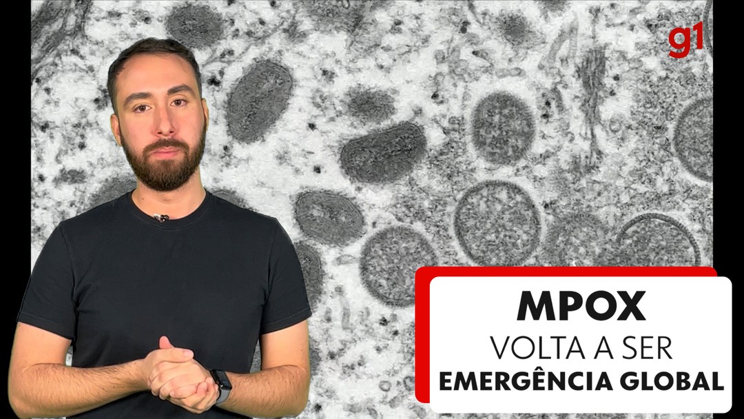 Mpox: veja em mapas a distribuição de casos e mortes pelo Brasil
