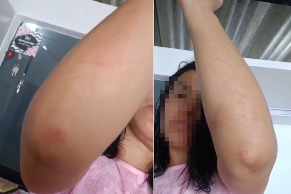 Mulher ficou com braços feridos após agressões em Praia Grande (SP). — Foto: Arquivo pessoal