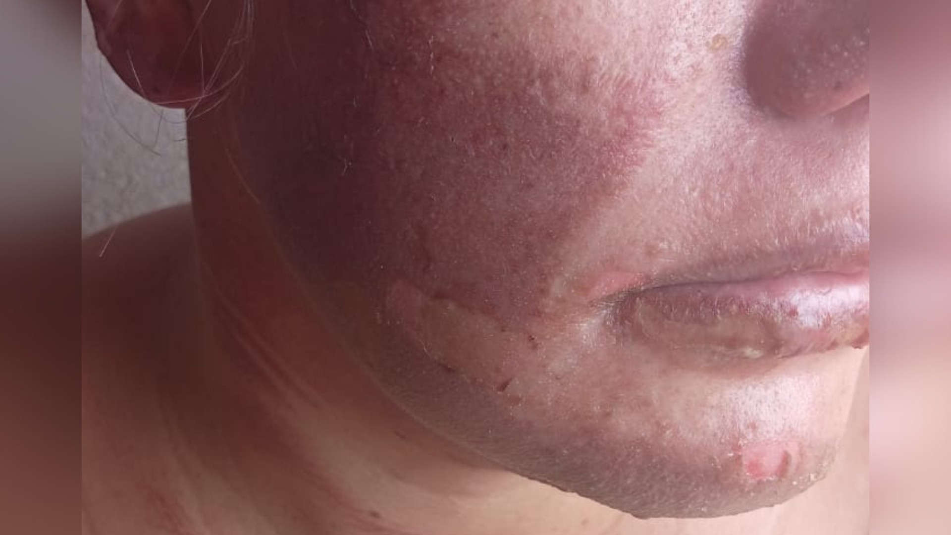 Grávida tem casa invadida e é atacada com gasolina e fogo em MG