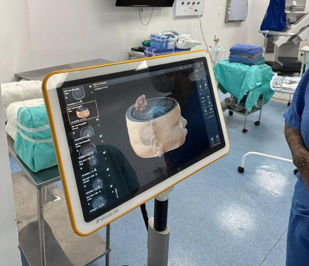 Profissionais usaram equipamentos de última geração para realizar a cirurgia — Foto: ASCOM/HGCA