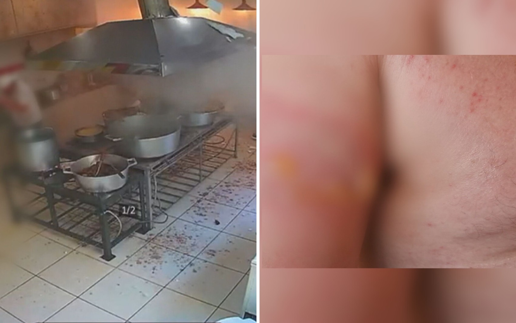 Panela de pressão explode, causa queimaduras em voluntário de igreja e abre buraco no teto de cozinha; vídeo
