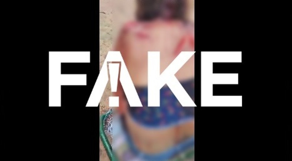 É #FAKE que mulher ferida mostrada em vídeo foi atacada por onça — Foto: Reprodução