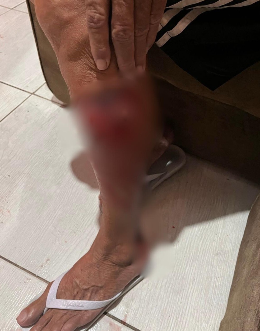 Idoso atacado por cães em Campina Grande precisou de 30 pontos para fechar ferimento — Foto: Divulgação/Stenio Soares/Arquivo pessoal