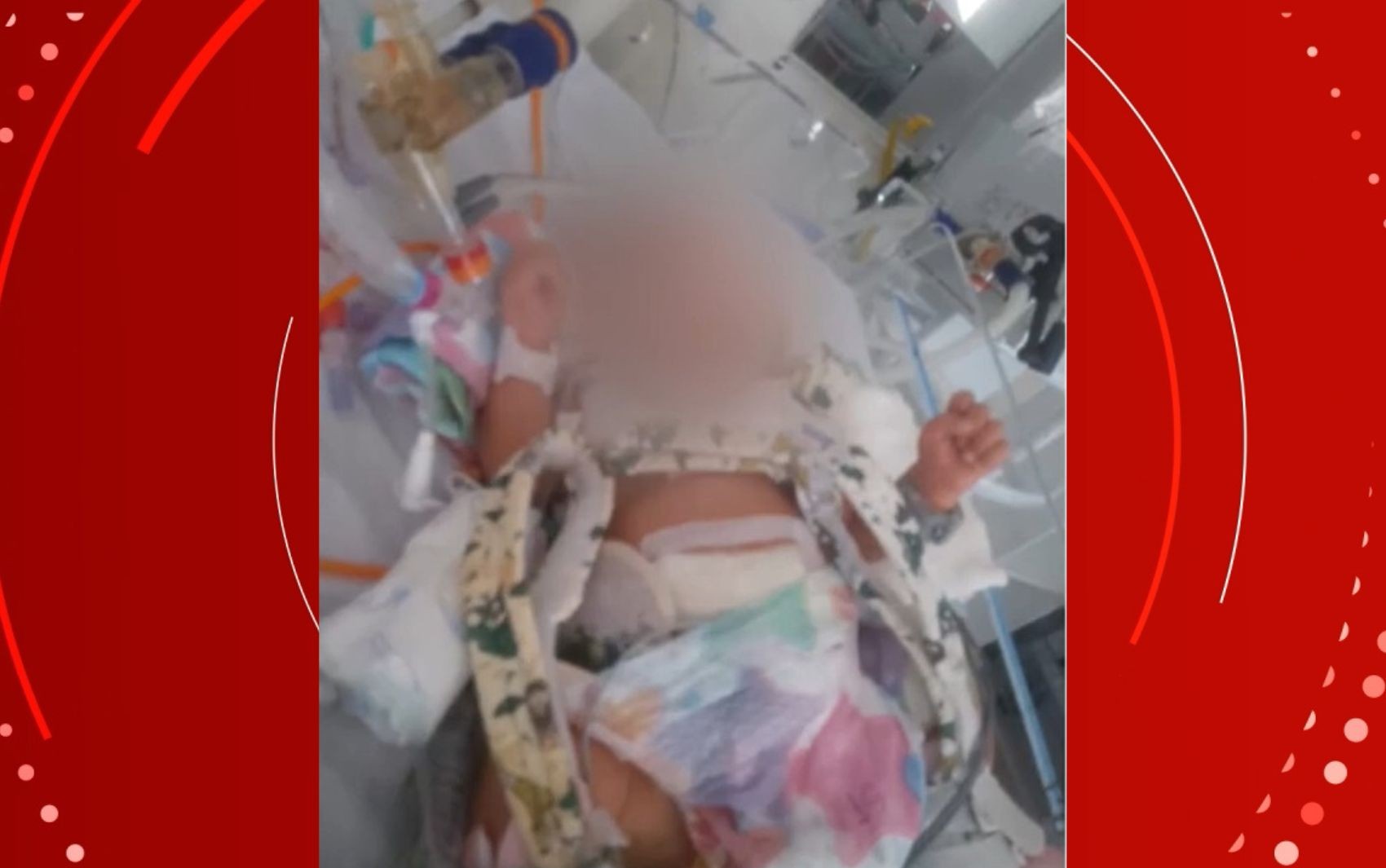 Família acusa maternidade de negligência após bebê sofrer fratura durante parto e desenvolver infecção na Bahia