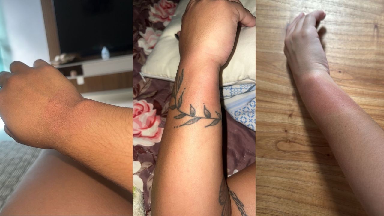 Fãs relatam queimaduras após uso de pulseiras em show de Luan Santana em BH: 'ardia muito'