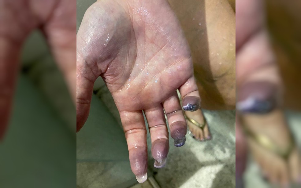 Mão da tatuadora Camila Gama Braga de Oliveira, que teve o braço amputado por complicações após cirurgia em Goiânia Goiás — Foto: Arquivo Pessoal/Camila Gama