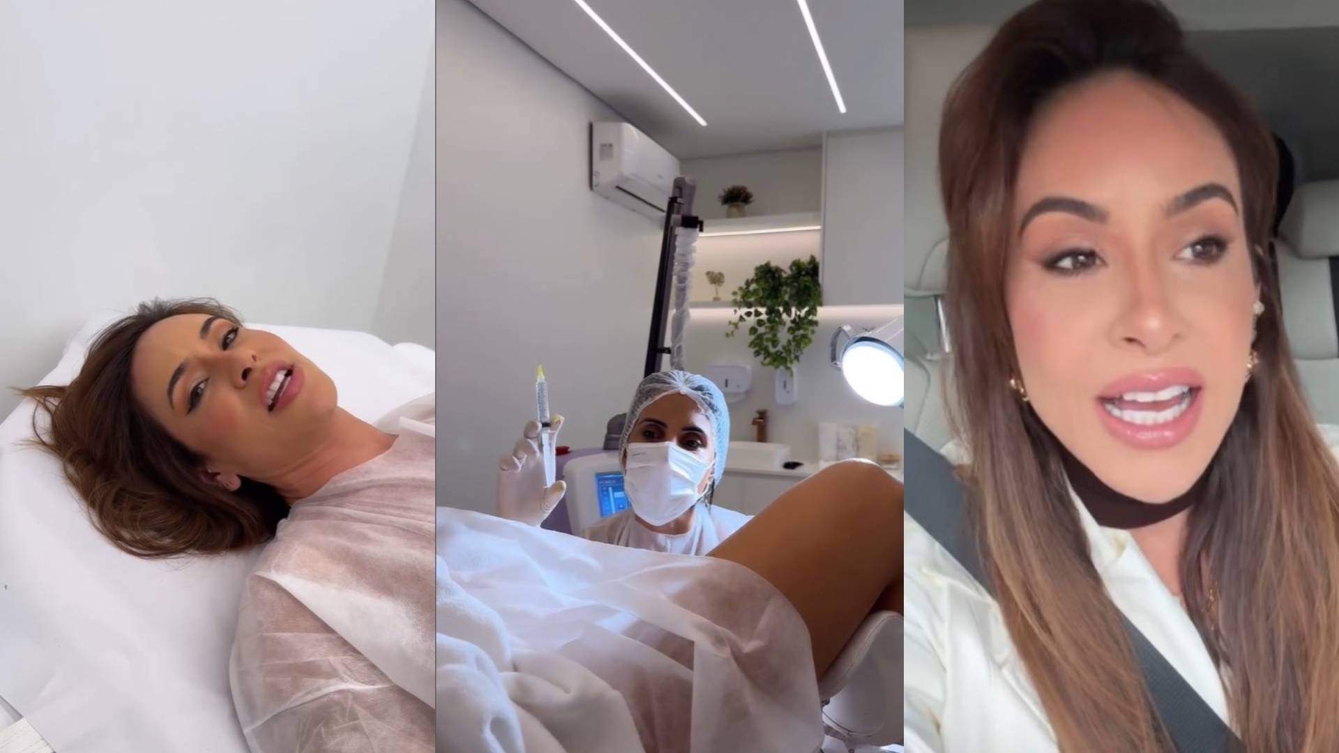 Fotos da cirurgia íntima da mãe da ex-BBB Vanessa Lopes geram debate: entenda o que é a labioplastia e quando é indicada