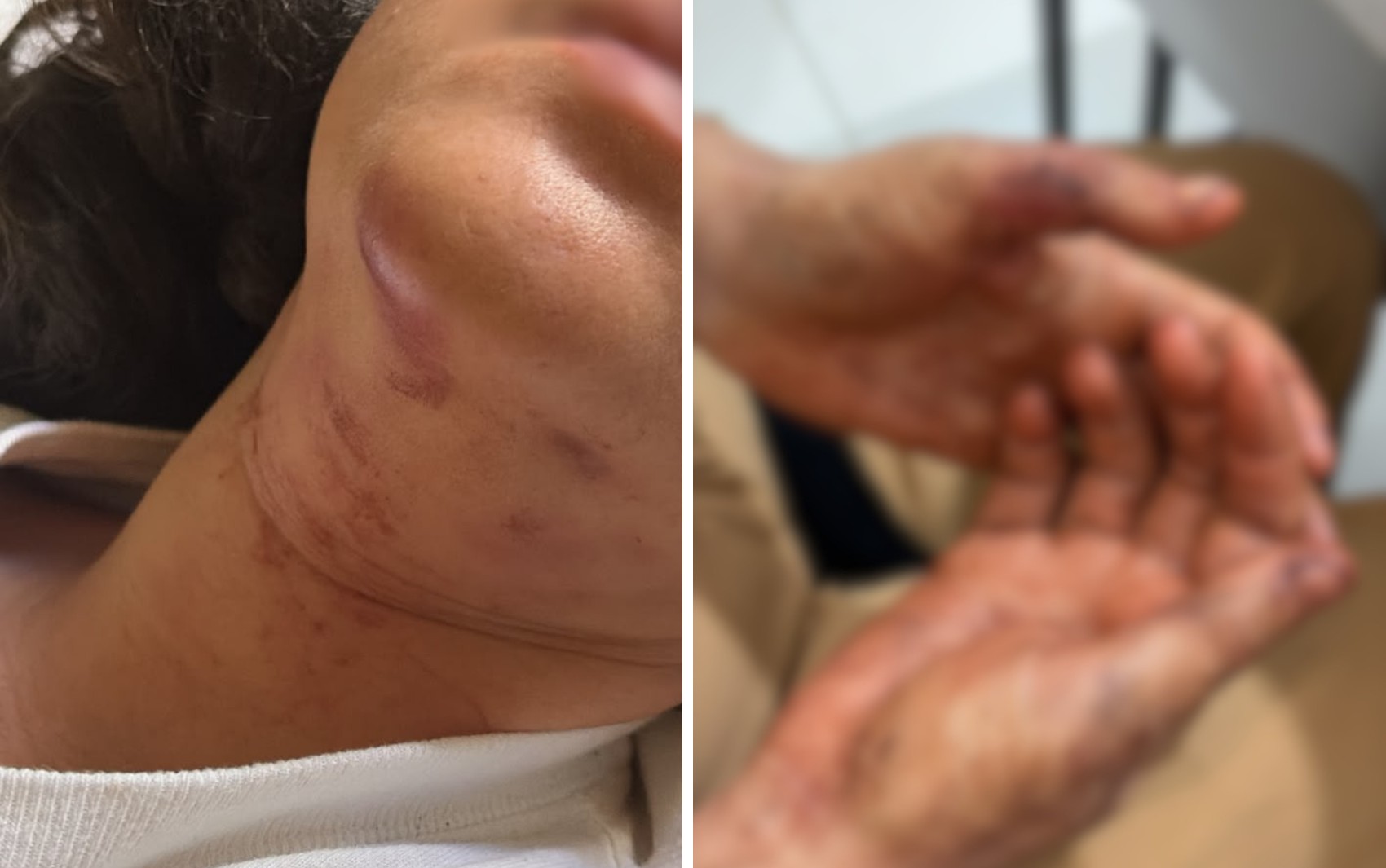 Mulher é enforcada, colocada em porta-malas e ameaçada de morte pelo ex em Serrana, SP
