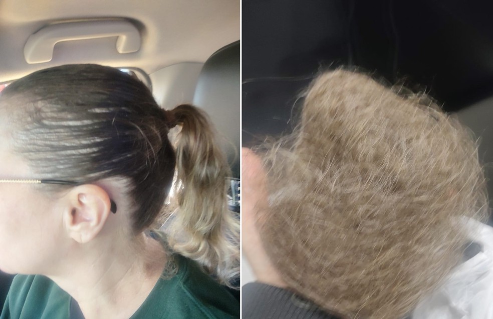 Cabelo de Karina caiu por estresse após agressão em hospital — Foto: Arquivo Pessoal