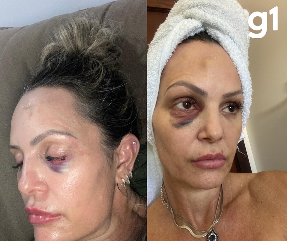 Débora contou que relacionamento sempre foi marcado por violências — Foto: Arquivo pessoal