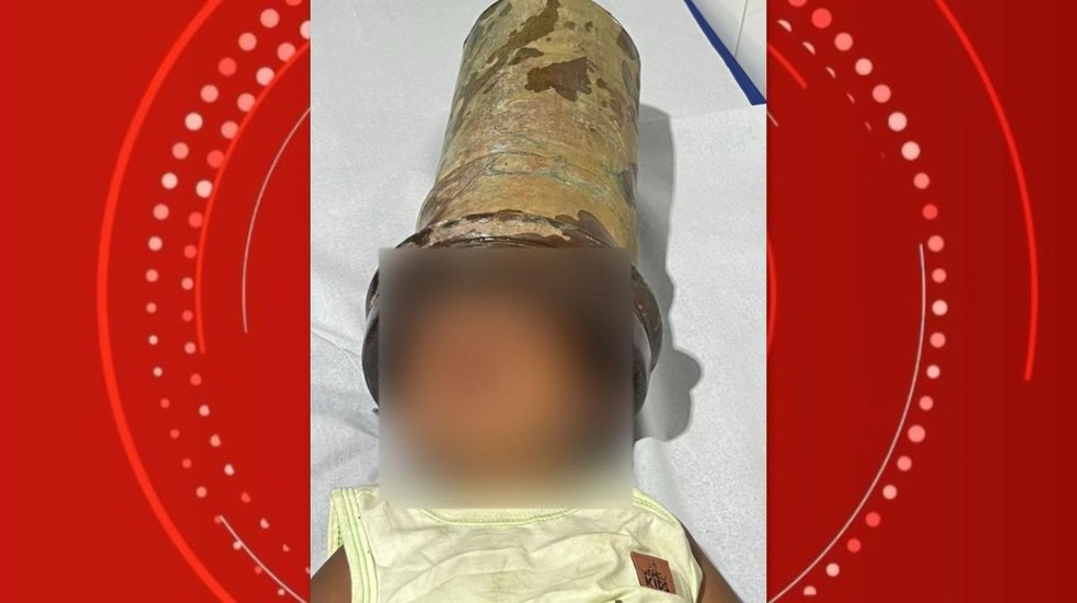 Menino prende cabeça dentro de tubulação em Capela Alagoas — Foto: Arquivo pessoal