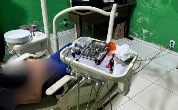 Técnico em prótese dentária é flagrado atuando como dentista em clínica clandestina no interior do MA