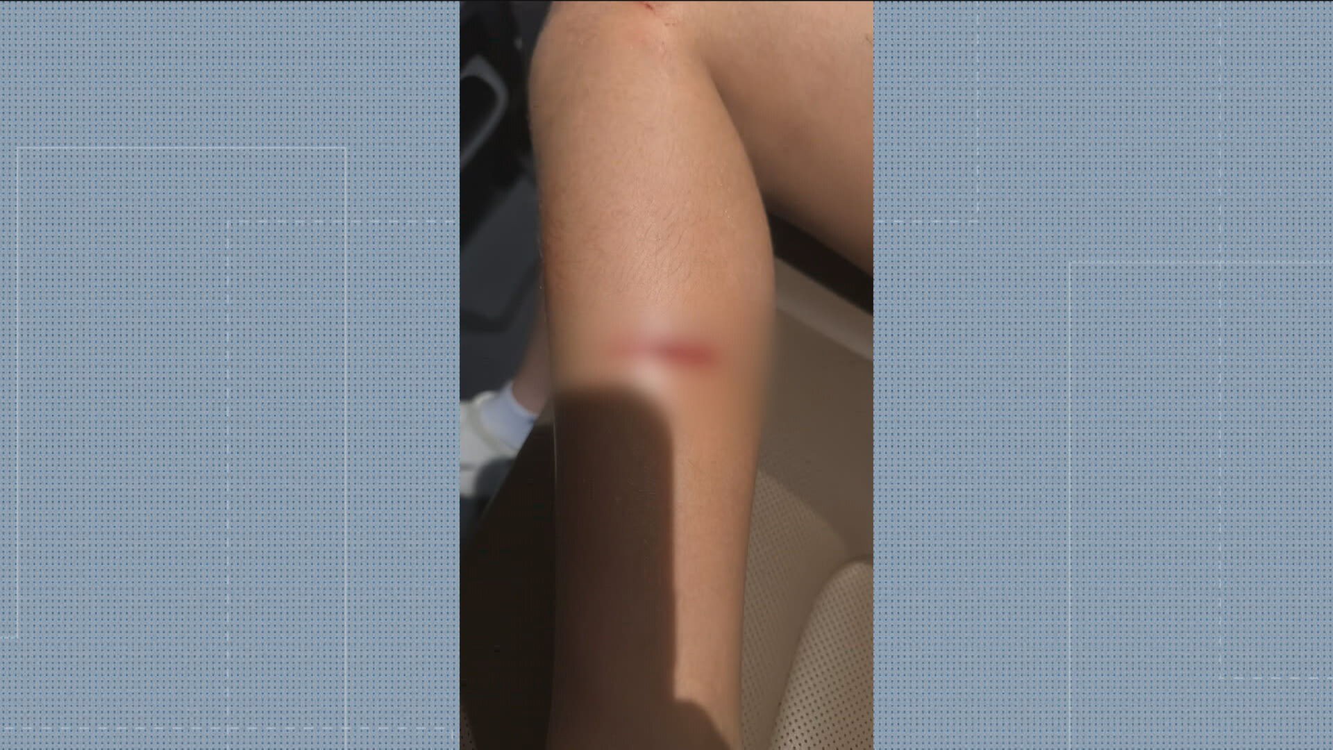 Menina de 11 anos é atropelada por moto na calçada ao sair de aula de dança no Grajaú, Zona Norte do Rio