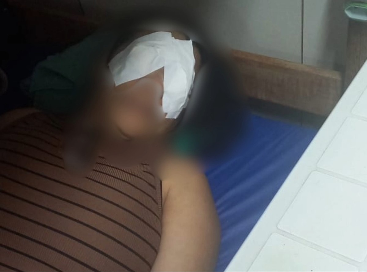 Servidora sofre queimadura na córnea após uso de produto químico no hospital Walfredo Gurgel