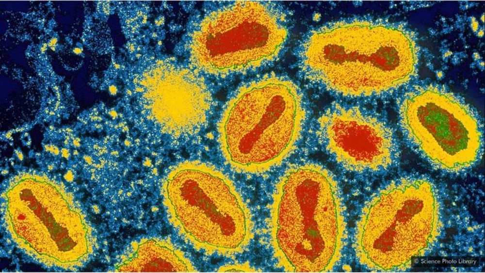 Pesquisadores encontram primeira evidência molecular de varíola transportada da Europa para as Américas no período colonial