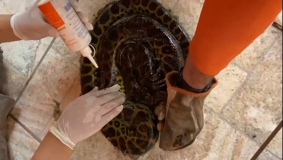 Sucuri teve 30% do corpo queimado e queimaduras de 2° grau — Foto: Reprodução