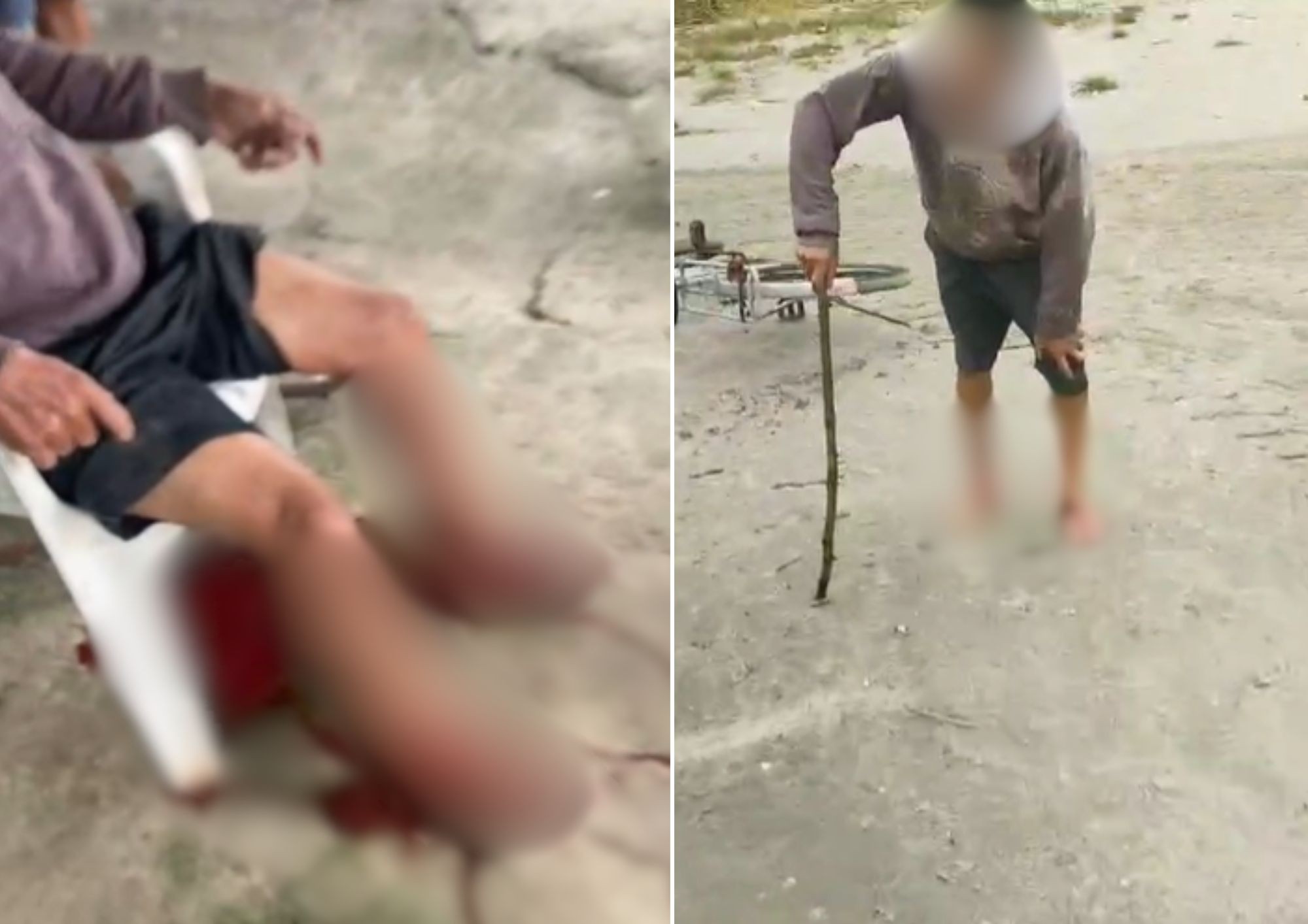 Homem tem pernas dilaceradas por cachorros em ataque no litoral de SP; VÍDEO