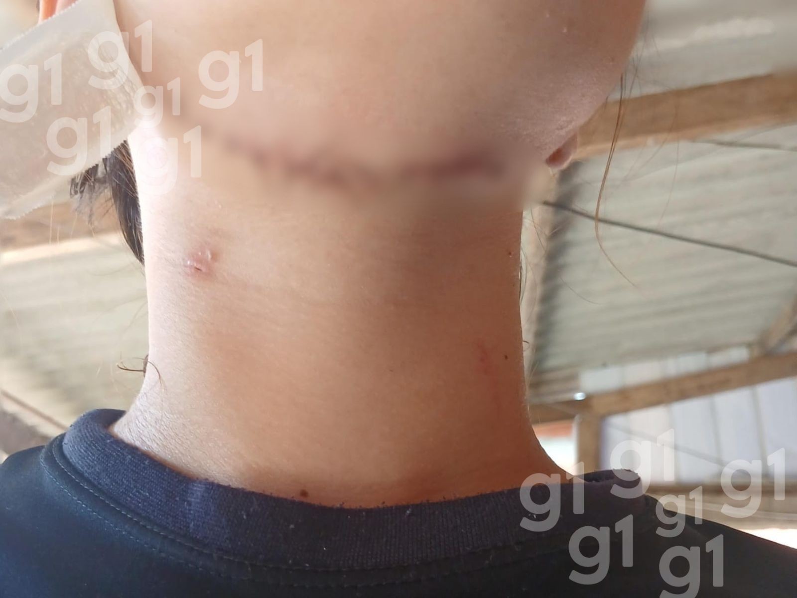 Suspeito pediu para reatar namoro antes de tentar degolar adolescente no AC: 'Deu um mata-leão'