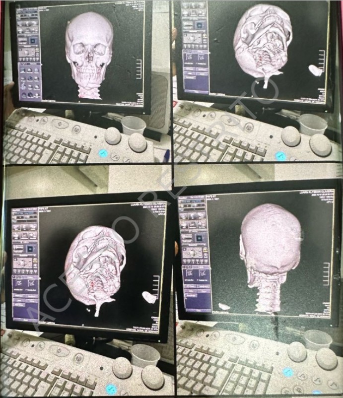 Professor universitário e esposa empresária são indiciados por torturar amante após descoberta de traição em RR