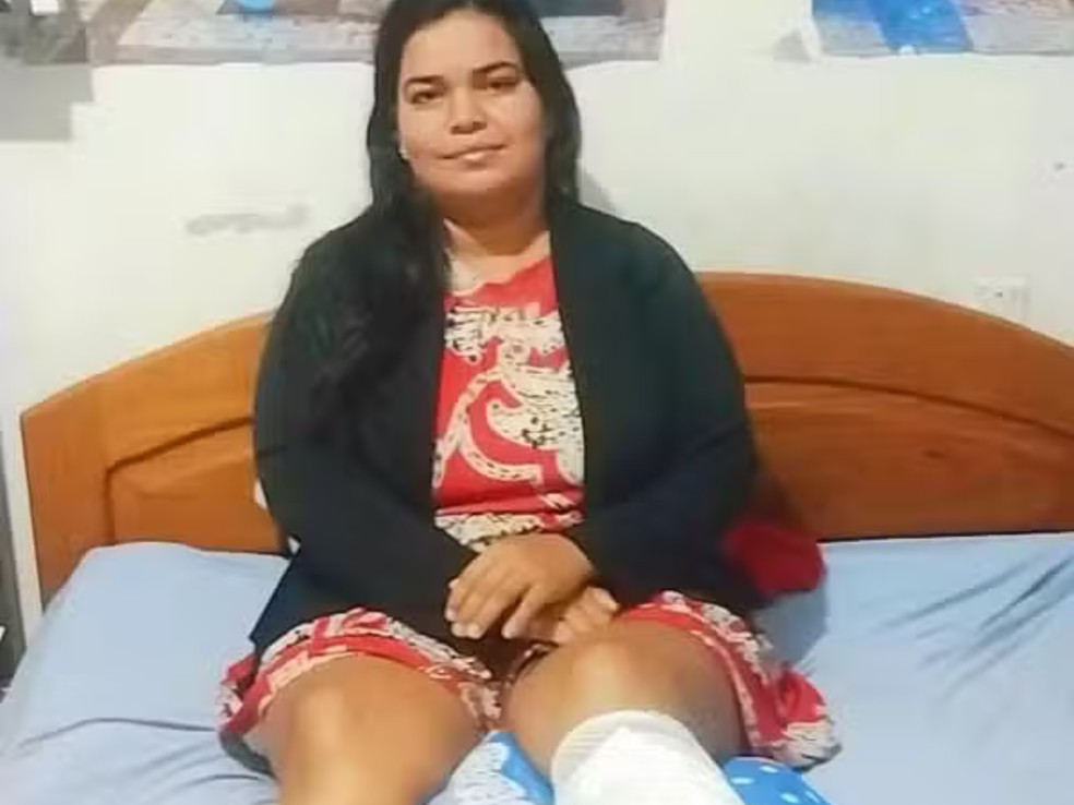 Raiane Xavier sofreu um corte profundo na perna esquerda, ferimentos nos dedos e mãos — Foto: Arquivo pessoal