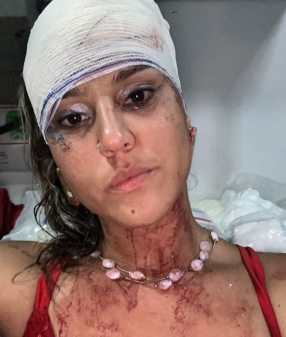 Mulher denuncia ter sido agredida por policiais militares durante o bloco Homem da Meia-Noite, em Olinda — Foto: Reprodução / Acervo pessoal