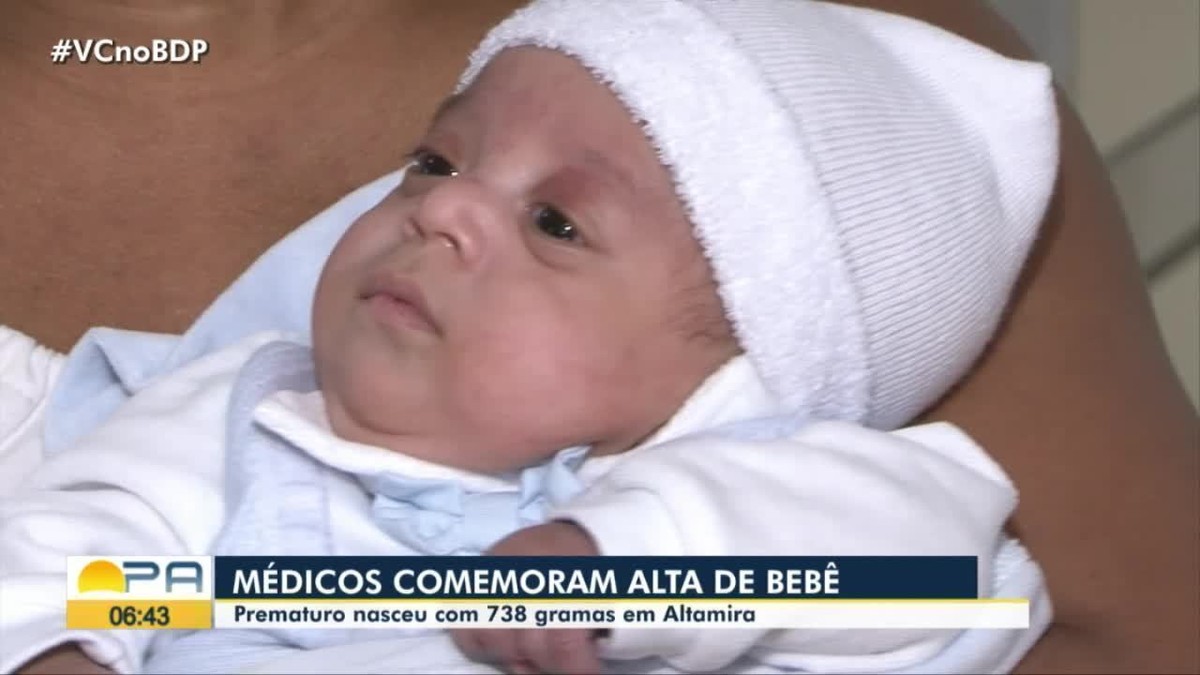 Bebê Que Nasceu Com 738 Gramas Recebe Alta Após Cinco Meses Internado