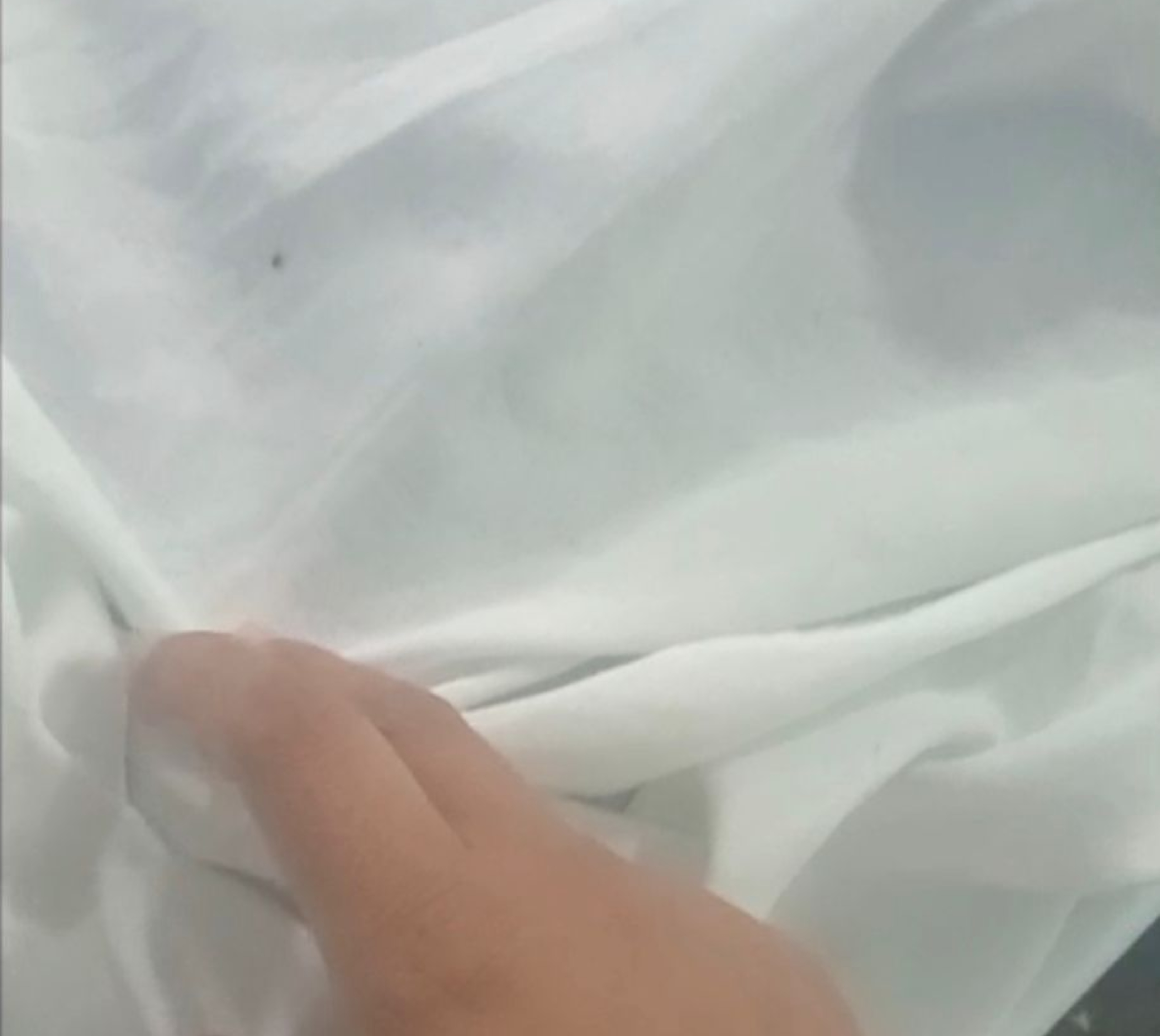 Paciente filma carrapatos em lençóis de maternidade em Boa Vista