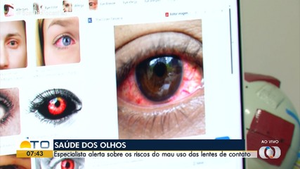 Médico orienta como evitar lesões nos olhos ao usar lentes de contato