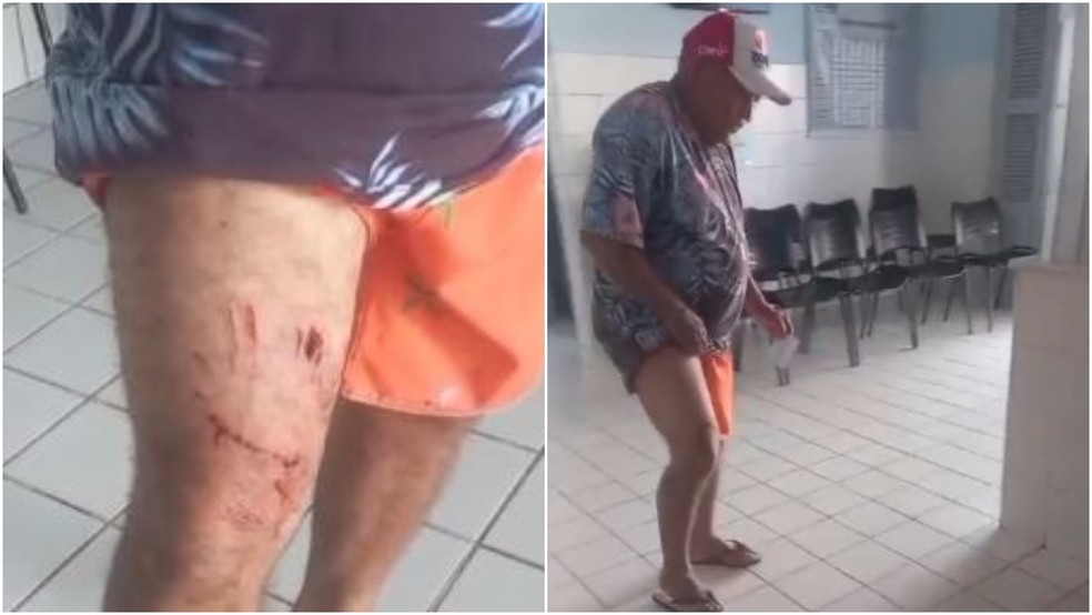 Raimundo Alves dos Santos, de 67 anos, teve a coxa direita mordida por um jacaré — Foto: Reprodução