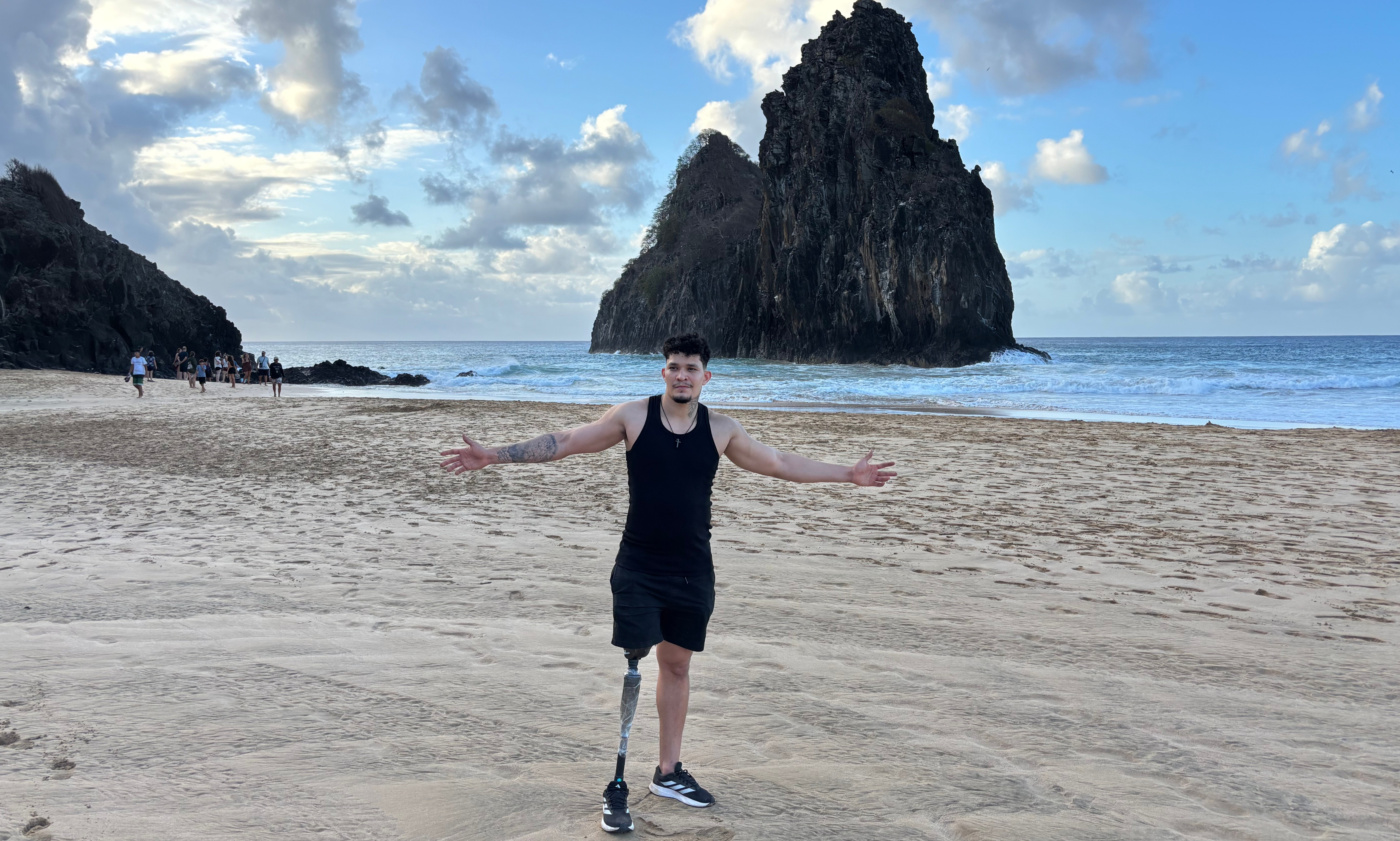 Ambulante baleado por delegado volta a Fernando de Noronha após amputação da perna 