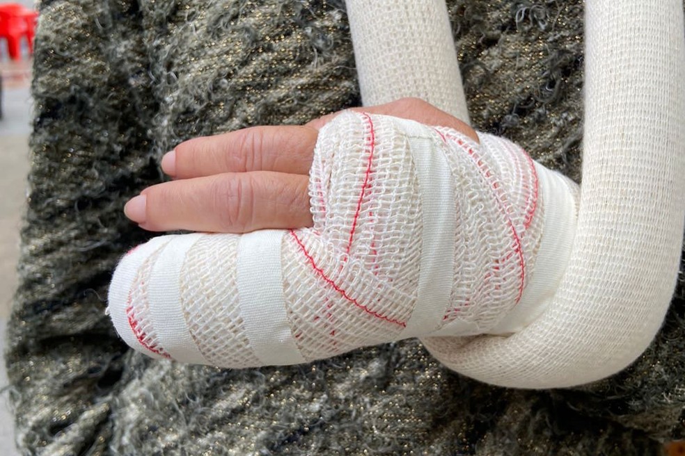 Segundo advogado do Bar da Casa, a colaboradora envolvida na confusão quebrou dois dedos — Foto: Arquivo Pessoal