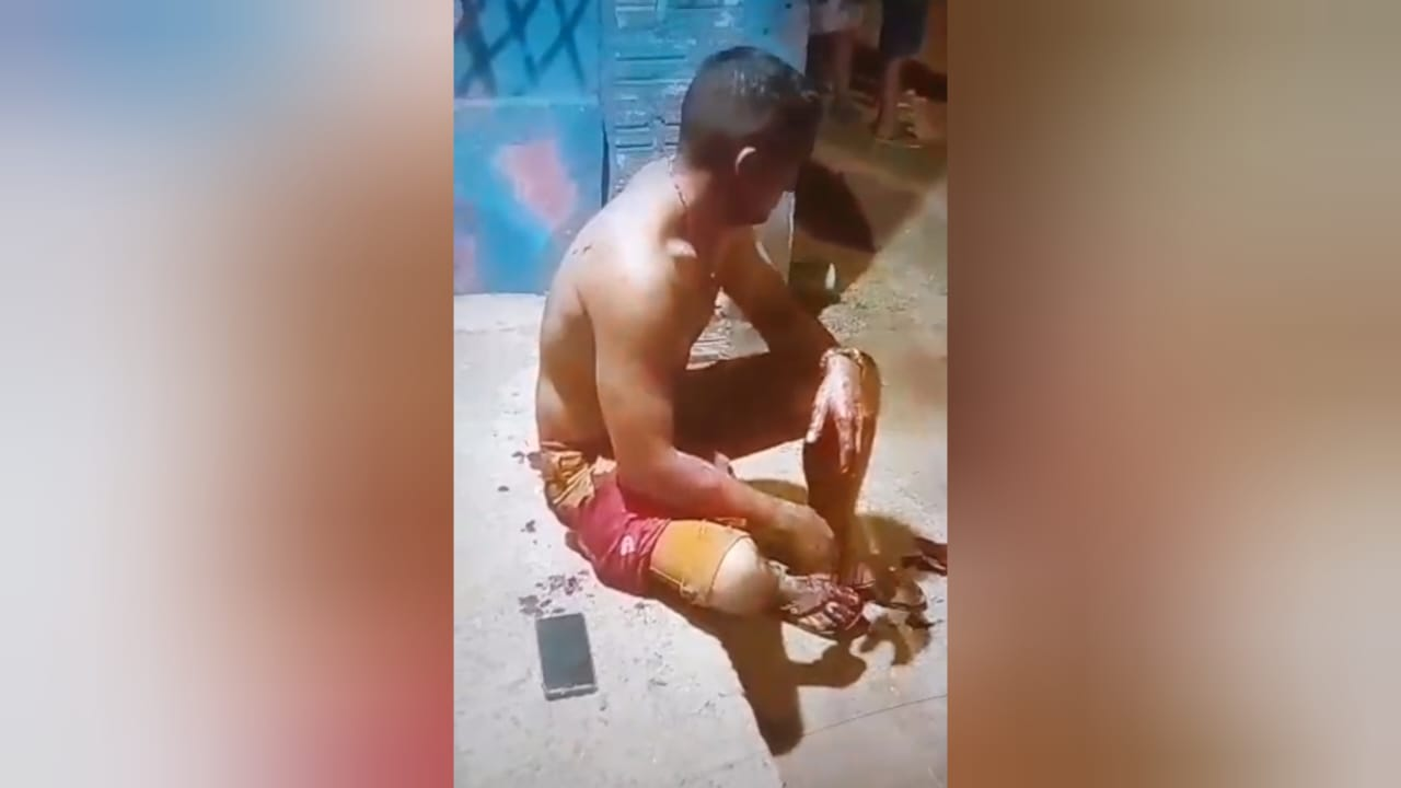 Homem é socorrido e levado ao Pronto Socorro após levar várias facadas em briga de bar em Santarém