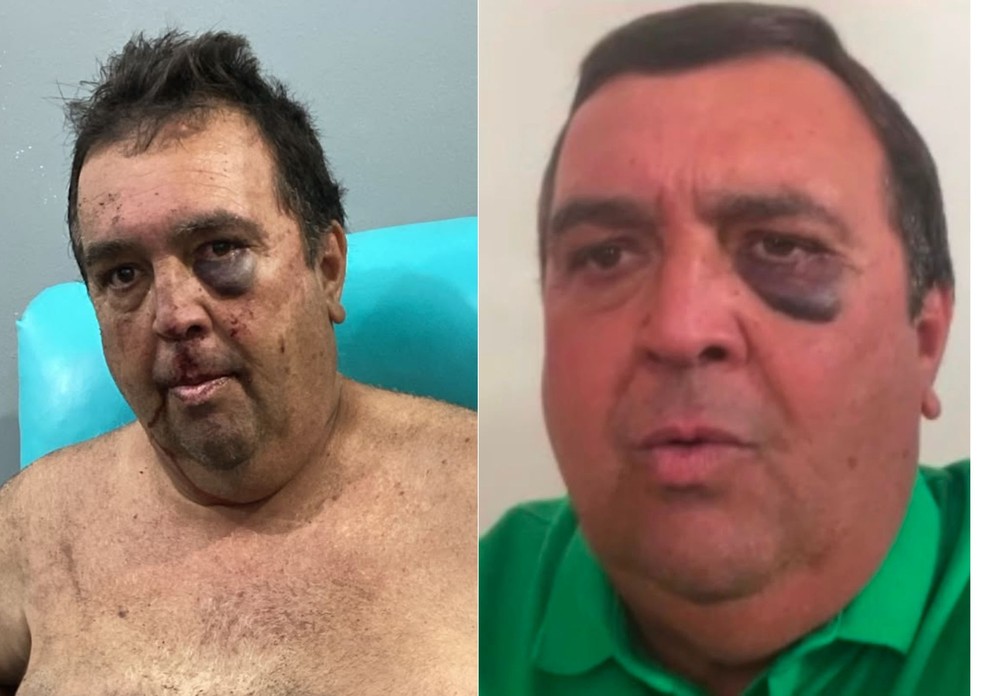 Vereador é agredido e amarrado em sequestro relâmpago no interior do RN — Foto: Cedida