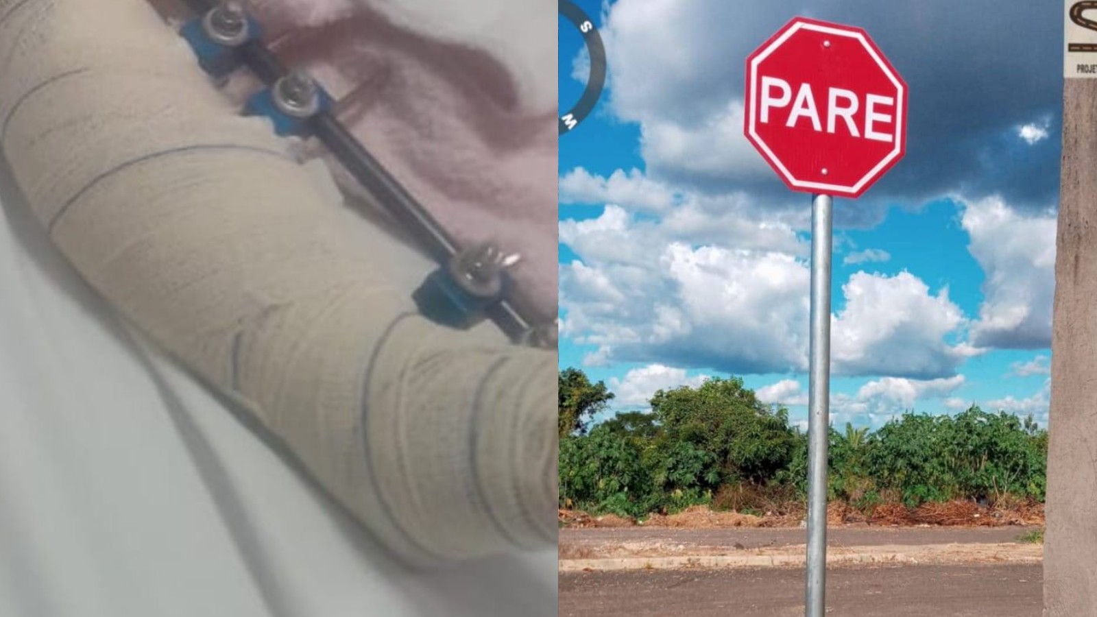 Menina de quatro anos é atropelada enquanto brincava na rua em Teresina: 'motorista não prestou socorro', diz pai