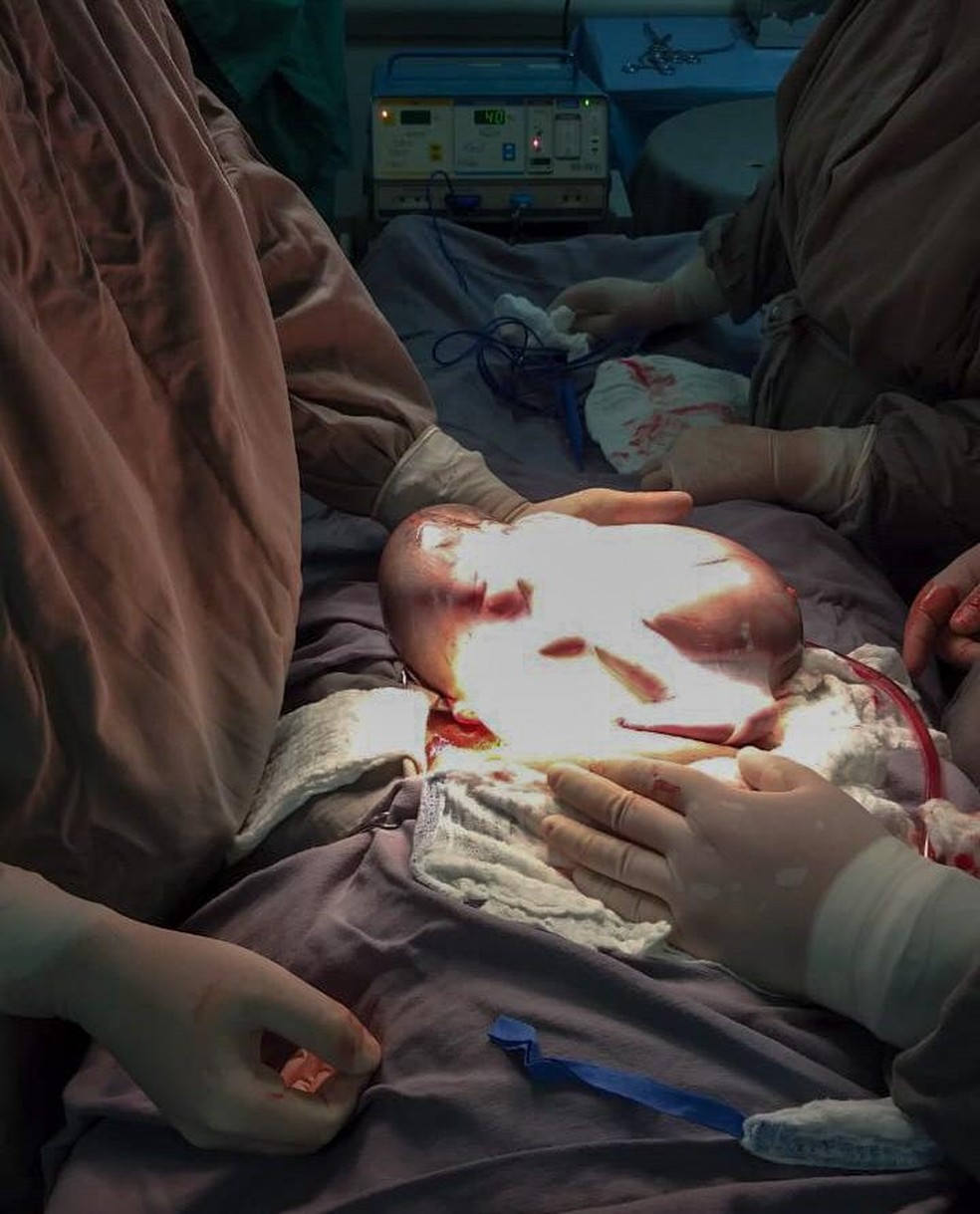 Bolsa parto hospital publico online