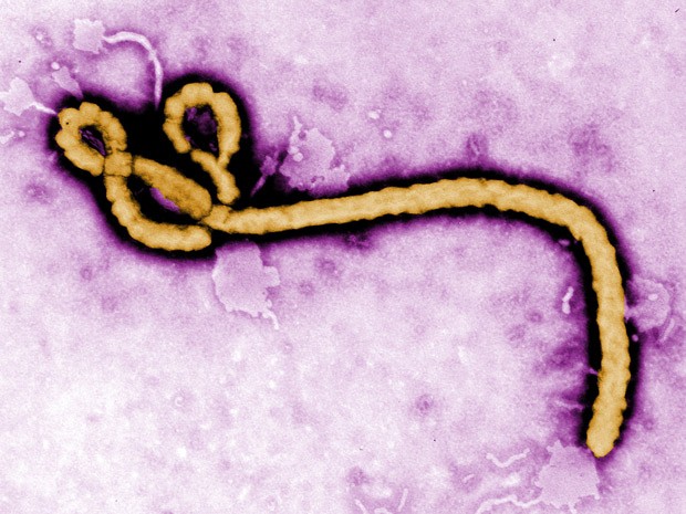 França registra 1° caso de ebola; paciente é um médico que atuava na República Democrática do Congo
