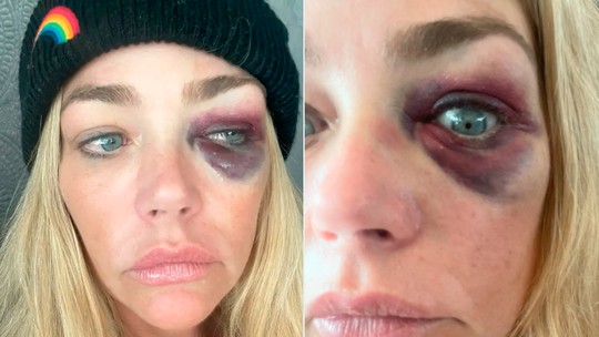 Denise Richards acusa ex-marido de agressão - De acordo com a 'People', a atriz e modelo conseguiu uma medida protetiva temporária após acusar o ex-marido, o empresário Aaron Phypers, de violência doméstica.