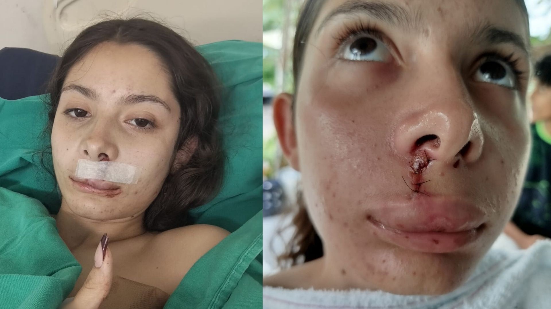 Adolescente morre e cantora é baleada na boca momentos antes de se apresentar em Igarassu