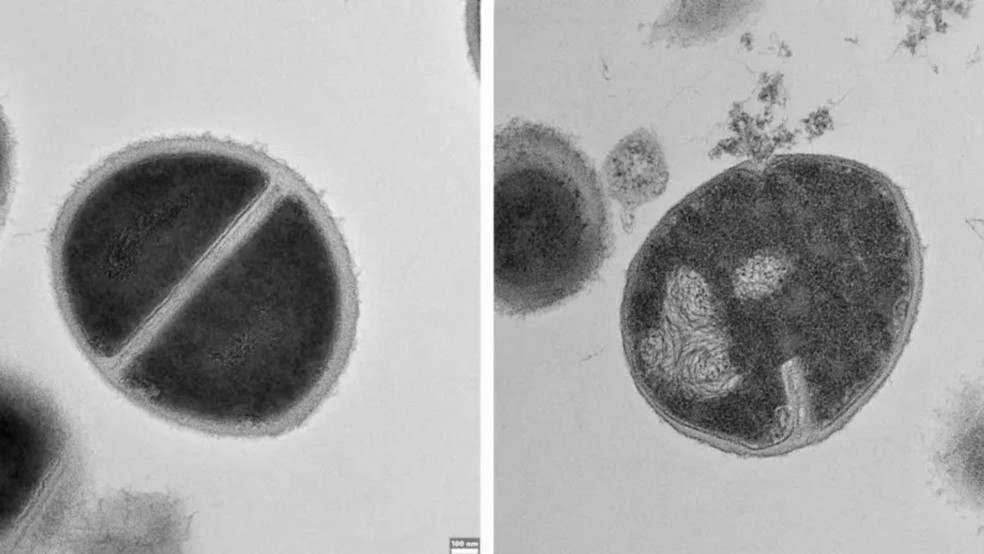 Imagens da bactéria Staphylococcus — uma saudável à esquerda, e outra sendo destruída à medida que sua camada externa é rompida por antimicrobianos produzidos pelo proteassoma — Foto: Weizmann Institute of Science/via BBC