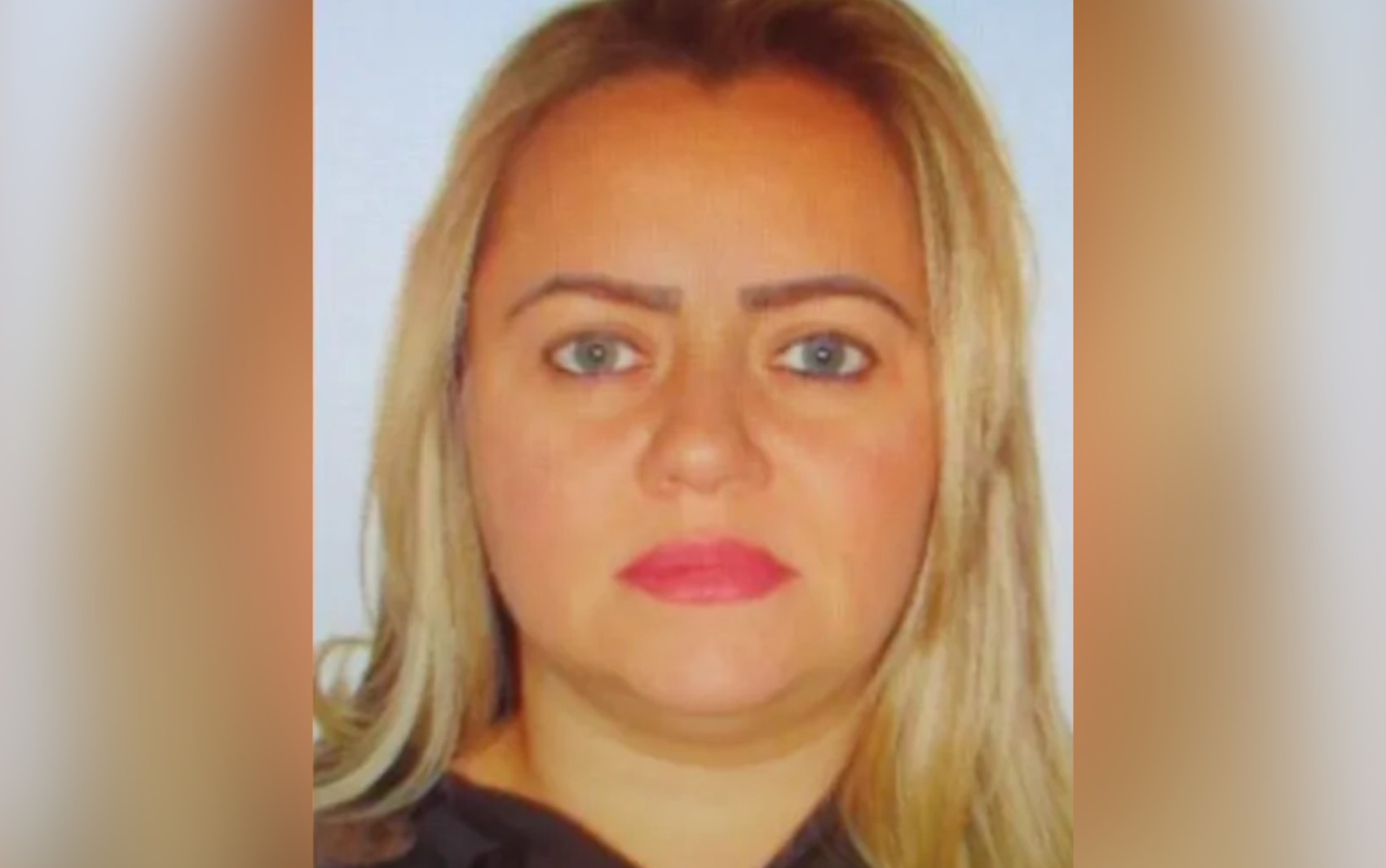 Enfermeira que causou graves lesões em pacientes é presa após nova vítima denunciar que teve infecção nos seios, diz delegada