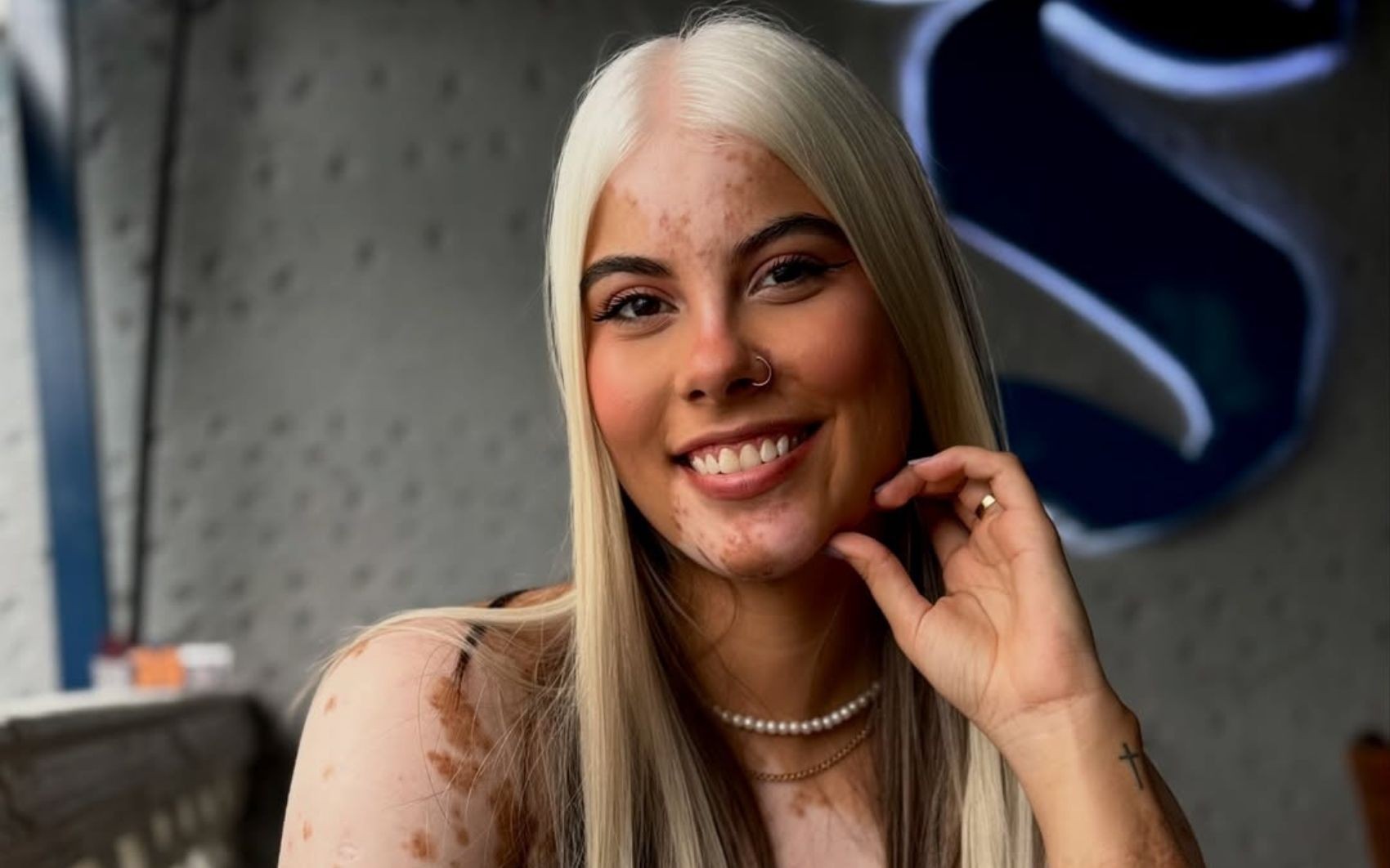 Influenciadora inspira ao mostrar condição rara que deixa o cabelo branco: 'Aprendi a me amar'