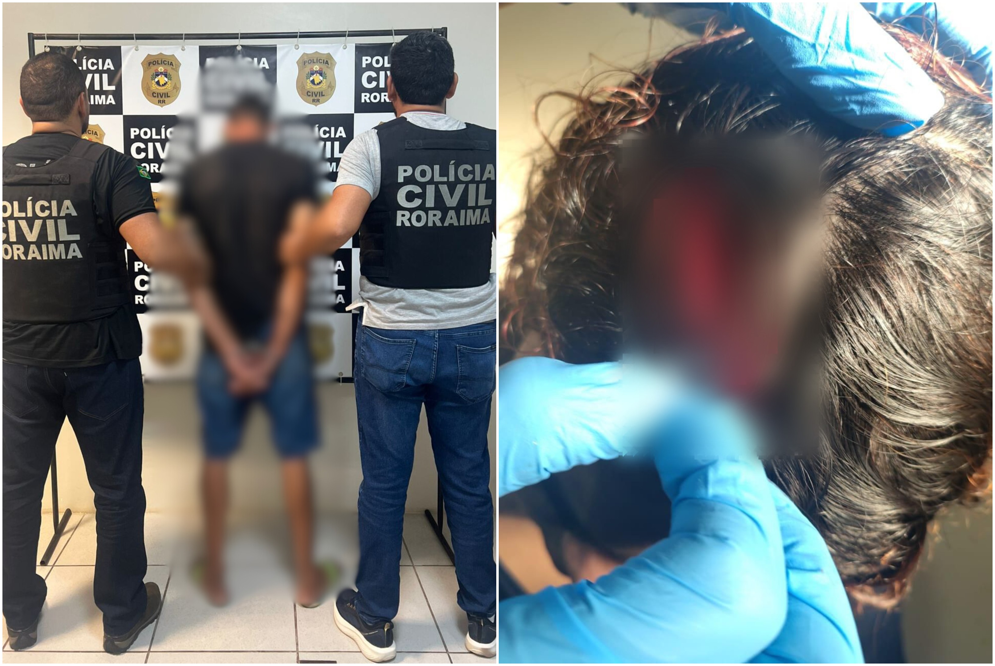 Pintor é preso por agredir jovem na cabeça com madeira após ser cobrado por dívida de R$ 350 em RR