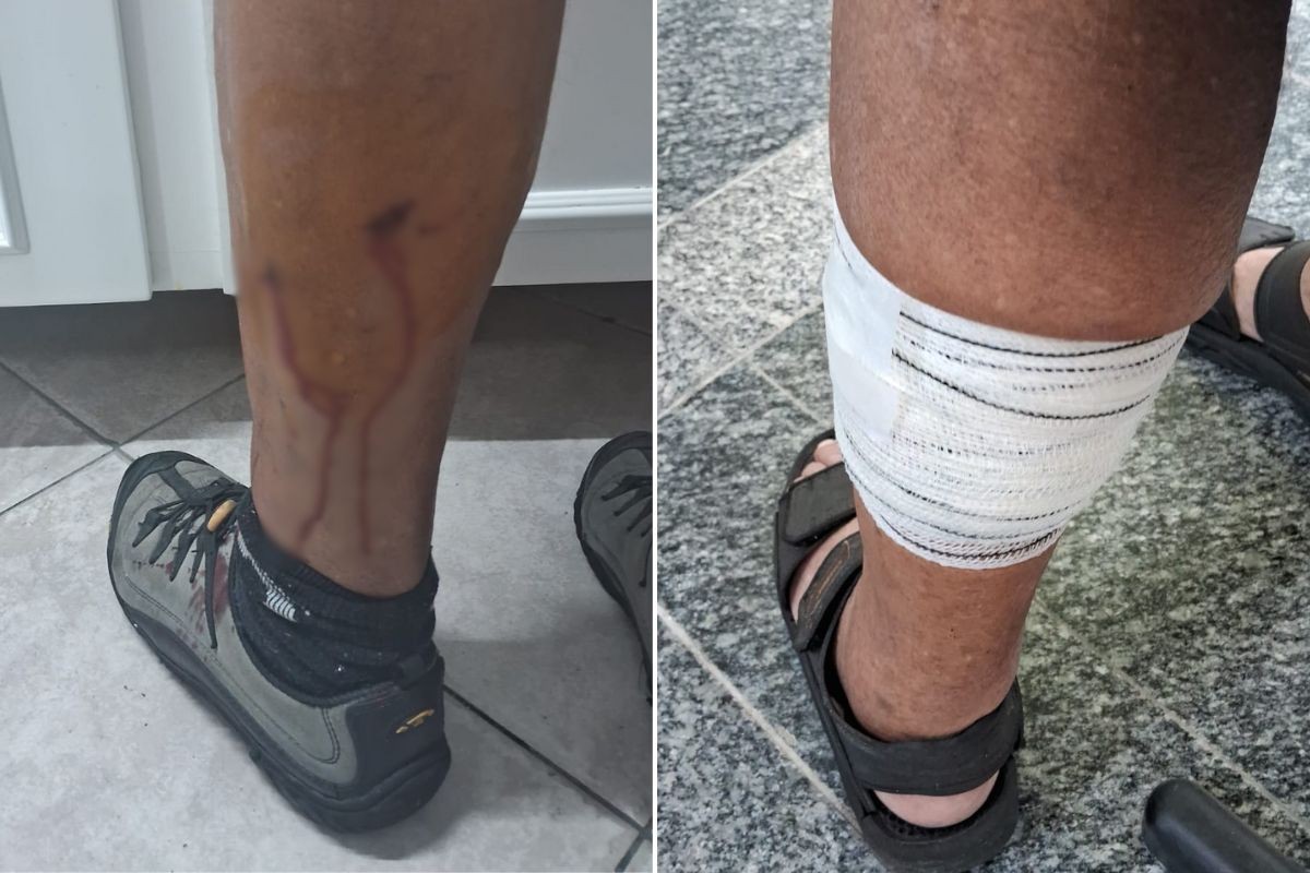 Idoso é atacado por cachorro 'caramelo' enquanto andava de bicicleta na orla da praia do litoral de SP