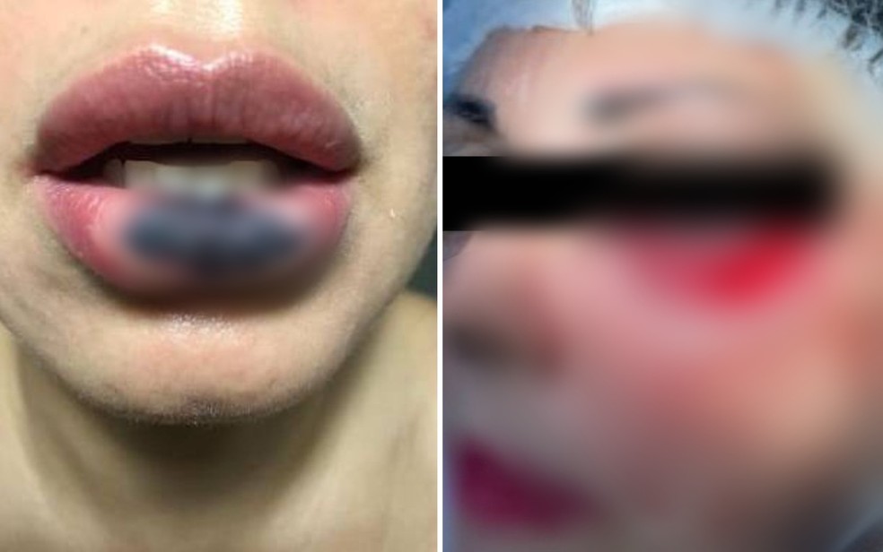 Dentista é suspeita de deformar pacientes ao realizar cirurgias estéticas, em Goiânia, Goiás — Foto: Divulgação/Polícia Civil