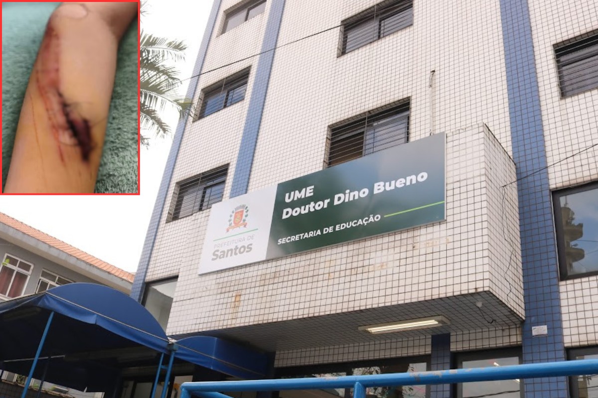 Menino com autismo se corta dentro de escola no litoral de SP e família cobra explicações