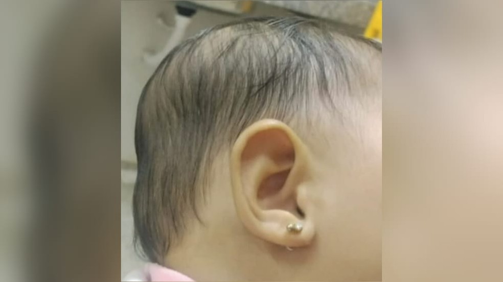 Criança foi internada e sobreviveu. — Foto: Reprodução/TV Verdes Mares