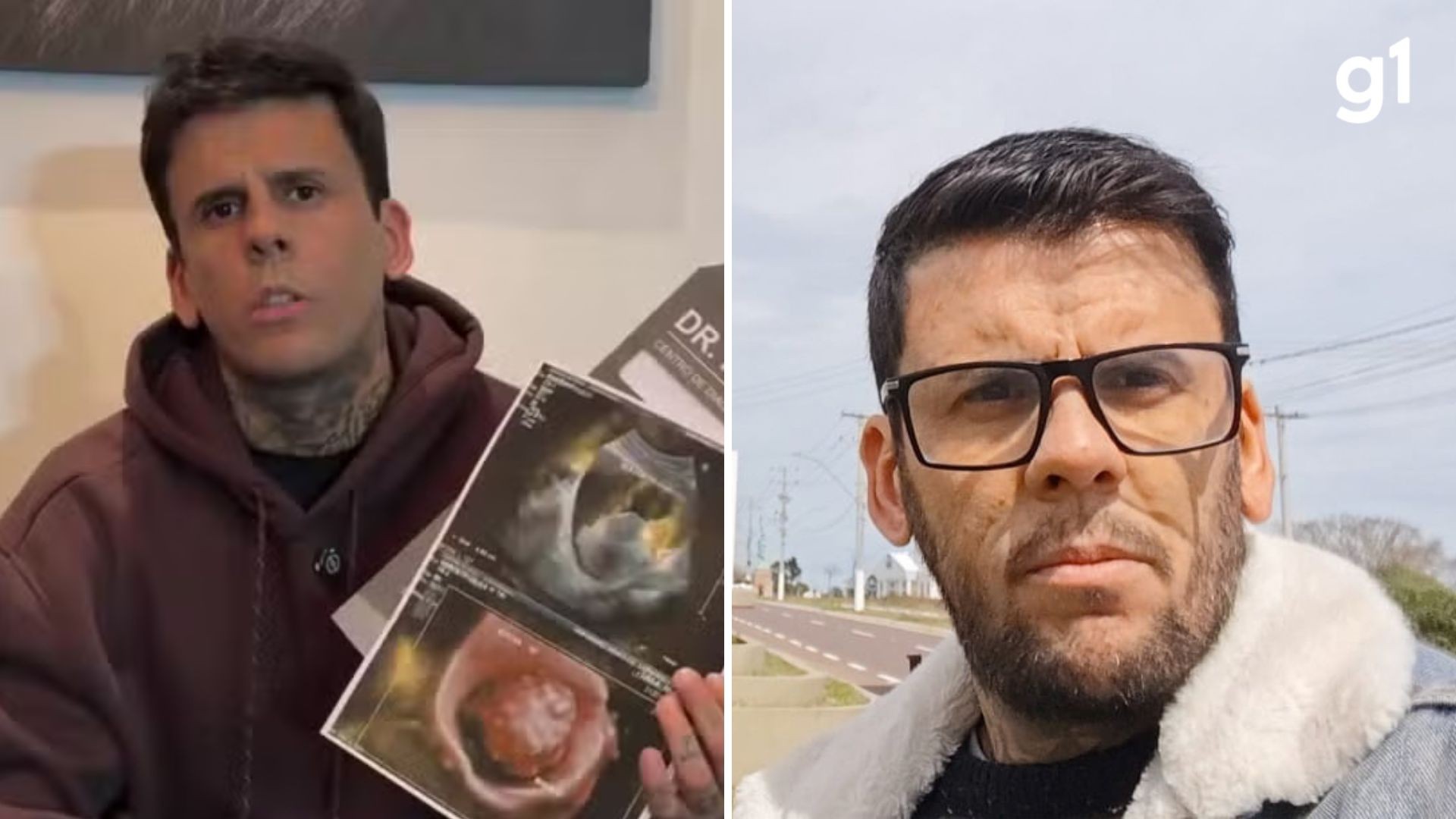 'Homem mais tatuado do Brasil' tem alta após cirurgia para retirar tumor e fala sobre os próximos passos do tratamento: 'Cada vez mais forte'
