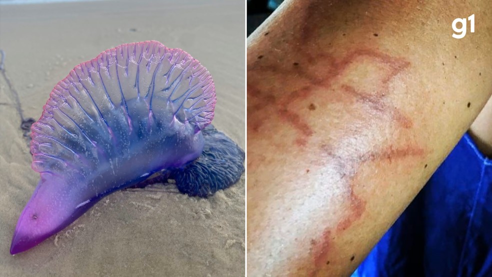 Caravelas-portuguesas causam mais de 500 queimaduras em um dia em praia do RS — Foto: Divulgação/Corpo de Bombeiros